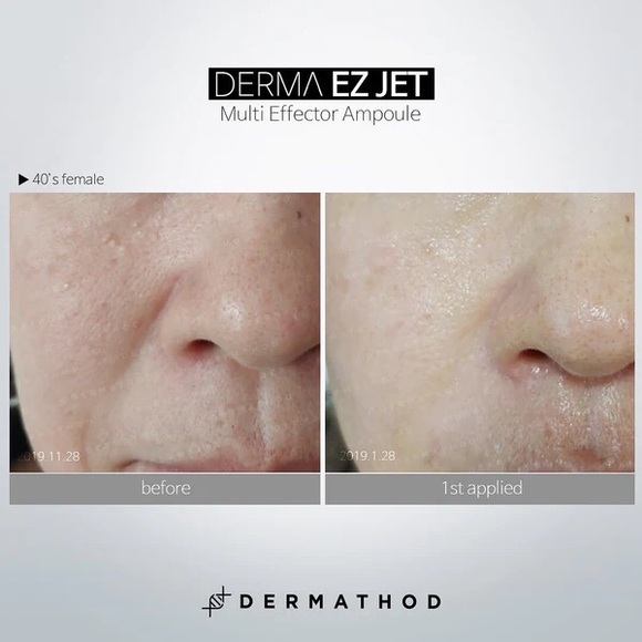 DERMATHOD LEVEL 345 RADIANCE PROFESSIONAL AMPOULE (8tubes) + Free Recovery Masks - Picture 3 of 4